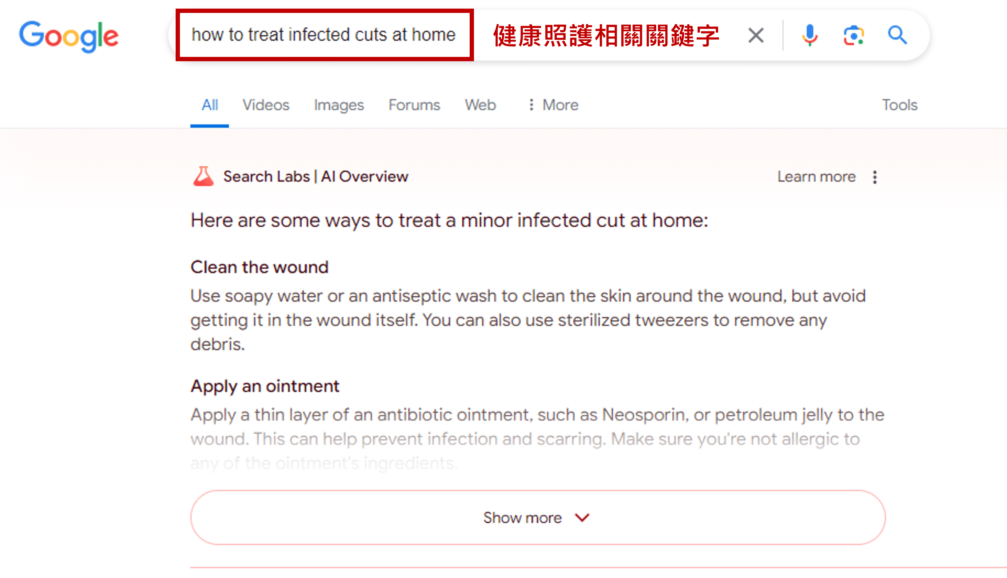 AI Overview 實際搜尋_健康照護相關關鍵字